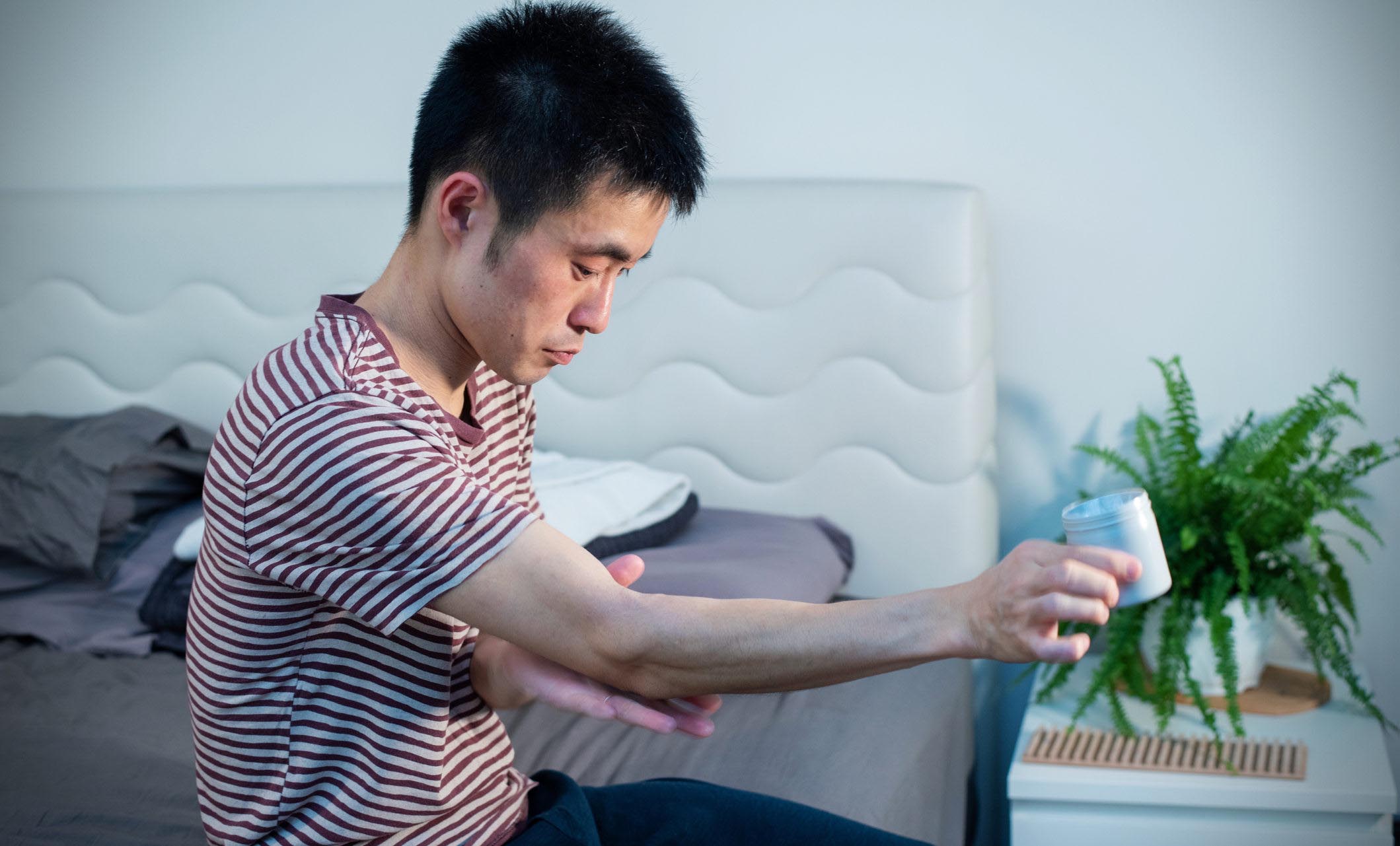 A man in his 30s using medicinal products for his eczema before bed