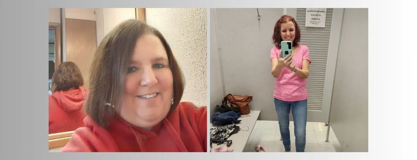 Michelle before and after weight loss surgery. 