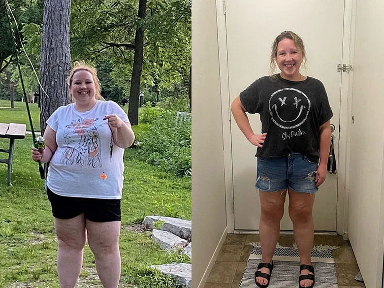 Christie's Weight Loss Before and After