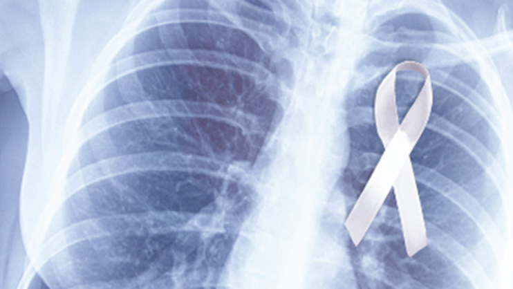 xray of lungs 