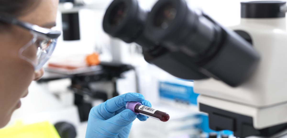 Scientist preparing to view a blood sample under a microscope in laboratory for medical testing.